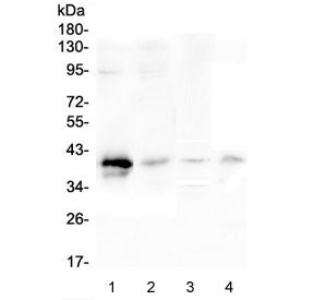Western blot testing of 1) human placenta, 2) human SGC-7901, 3) rat lung and 4) mouse lung lysate w