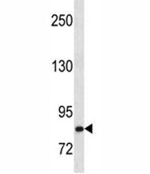 HGF antibody western blot analysis in Ramos lysate. Predicted molecular weight: 76-91 kDa (precursor