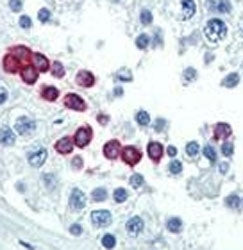 Cyclin D1 Antibody (CCND1)