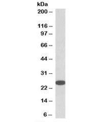 Western blot testing of HeLa lysate with RanBP1 antibody at 0.05ug/ml. Expected molecular weight: 23