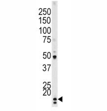 p-p21 Antibody (pT145)