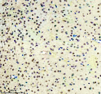 ISL1 Antibody / Islet 1, 100ul