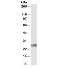 Western blot testing of human heart lysate with MT-ATP6 antibody at 0.1ug/ml. Predicted molecular we
