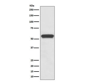 Western blot testing of rat brain lysate with Aromatase antibody. Predicted molecular weight ~58 kDa