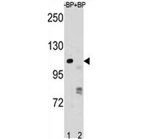 PARP1 Antibody, 0.08ml