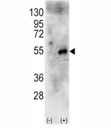 p70 S6 Kinase beta Antibody (RPS6KB2)