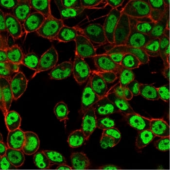 Immunofluorescent staining of PFA-fixed human HeLa cells using SMARCC1 antibody (green, clone PCRP-S