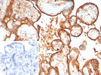 HEXB Antibody / Hexosaminidase B