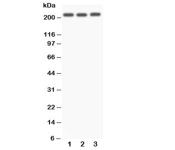 Western blot testing of NOTCH4 antibody and Lane 1: A549; 2: SMMC-7721; 3: HeLa. Predicted size: 210