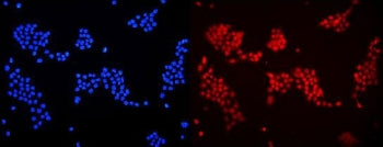 Immunofluorescent staining of FFPE human A431 cells with DDB1 antibody (red) and DAPI nuclear stain 