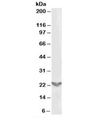 Western blot testing of A431 lysate with TGIF2 antibody at 0.3ug/ml. Predicted molecular weight: ~26