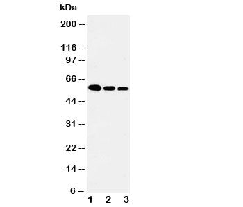 Western blot testing of Fetuin-A antibody and Lane 1: recombinant human protein 10ng; 2: 5ng; 3: 2.5