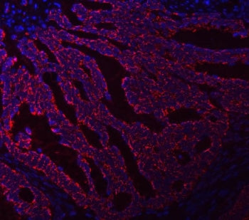 ASNS Antibody / Asparagine Synthetase