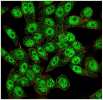 Immunofluorescent staining of PFA-fixed human HeLa cells using FOXL1 antibody (green, clone PCRP-FOX