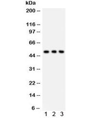 GLUT2 Antibody / SLC2A2