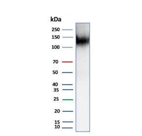 Western blot testing of human kidney tissue lysate using recombinant Cadherin 16 antibody (clone CDH