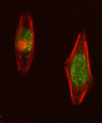 Immunofluorescent staining of FFPE human U-2 OS cells with Nucleoporin 107 antibody (green) and Phal
