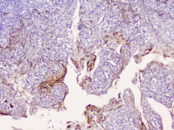 IHC staining of FFPE human tonsil tissue with CD1b antibody at 1ug/ml. HIER: boil tissue sections in