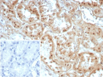 IHC staining of FFPE human kidney tissue with Collagen II antibody (clone COL2A1/8810R). Inset: PBS 