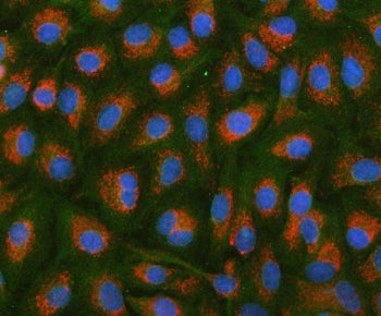 Immunofluorescent staining of FFPE human HSDL2 cells with PAPSS2 antibody (red), Phalloidin-iFluor 4