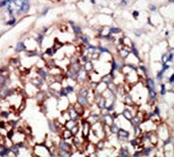 DYRK1B Antibody