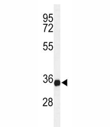 STING Antibody (TMEM173)