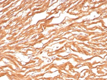 FABP3 Antibody