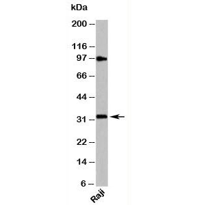 Western blot testing of human samples with MyD88 antibody at 4ug/ml. Predicted molecular weight: 33 