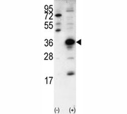 SNAIL Antibody (SNAI1)