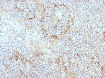 TIM-3 Antibody / HAVCR2
