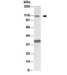 Western blot testing of human hippocampus lysate with KIT antibody at 1ug/ml. Observed molecular wei