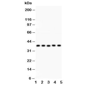Western blot testing of KLF6 antibody and Lane 1: human placenta; 2: rat testis; 3: (h) HeLa; 4: (h)