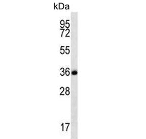 Western blot testing of human CCRF-CEM cell lysate with Follistatin like-3 antibody. Expected molecu