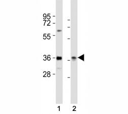 Western blot testing of PAX4 antibody at 1:2000 dilution. Lane 1: human HeLa lysate; 2: rat liver ly