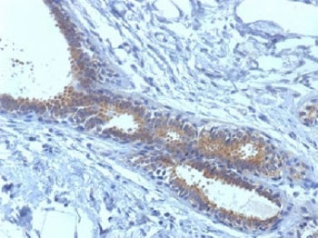 BRCA1 Antibody (Breast Marker)