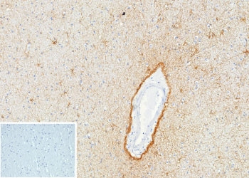 IHC staining of FFPE human brain tissue with GFAP antibody (clone GFAP/9424). Inset: PBS used in pla