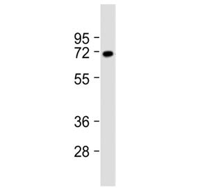 Western blot testing of rat brain lysate with VGLUT2 antibody at 1:2000. Predicted molecular weight 