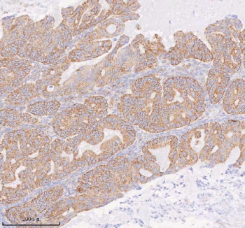 Immunohistochemical staining of COQ8B using anti-COQ8B antibody. COQ8B was detected in a paraffin-em