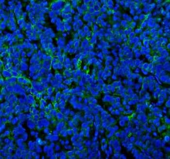 Immunofluorescent staining of SPA17 using anti-SPA17 antibody (green). SPA17 was detected in a paraf