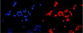 Immunofluorescent staining of FFPE human MCF7 cells with ETS Variant 5 antibody (red) and DAPI nucle