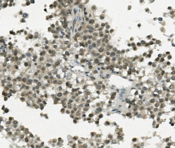 IHC staining of FFPE human testicular cancer with REC8 antibody. HIER: boil tissue sections in pH8 E