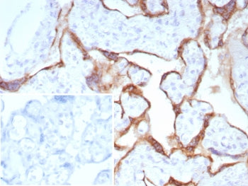 IHC staining of FFPE human placental tissue with Pappalysin-1 antibody (clone PAPPA/8804R). Inset: P