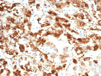 IHC staining of FFPE human adrenal gland tissue with Interleukin 18 receptor alpha antibody (clone I