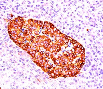 Chromogranin A Antibody
