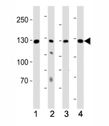 Western blot testing of human samples 1) K562 and 2) lung lysate and mouse samples 3) kidney and 4) 