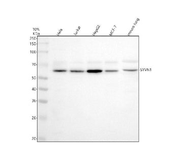 Western blot analysis of HRD1/SYVN1 using anti-SYVN1 antibody. Electrophoresis was performed on a 10