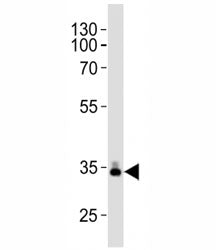 Western blot analysis of lysate from human plasma tissue lysate using ApoE antibody diluted at 1:100