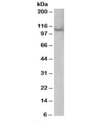 Western blot testing of A431 lysate with Rabenosyn 5 antibody at 0.3ug/ml. Predicted molecular weigh