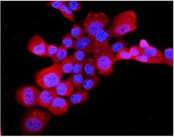 Immunofluorescent staining of FFPE human A431 cells with EDNRB antibody (red) and DAPI nuclear stain