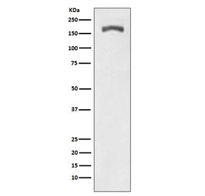 Western blot testing of lysate from PDGF-treated mouse NIH3T3 cells with phospho-PDGFRB antibody (pY